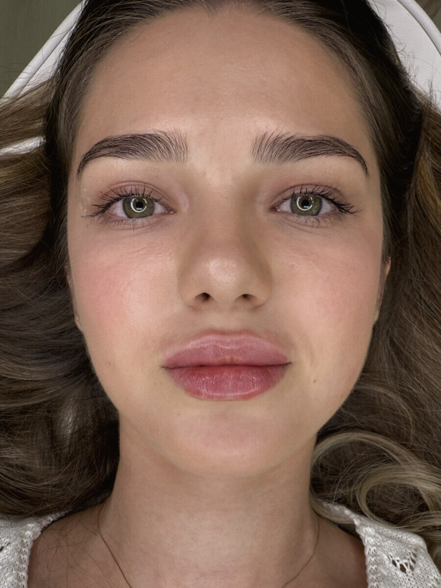 The same client's lips after the Russian Lips Signature Technique